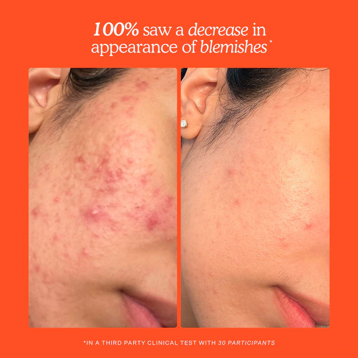 Mini SOS Daily Rescue Facial Spray - Image 12