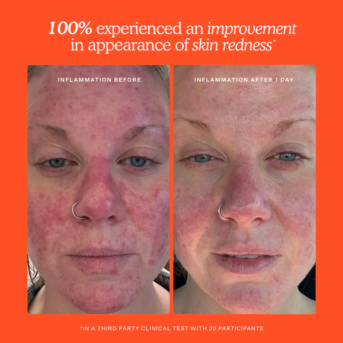 Mini SOS Daily Rescue Facial Spray - Image 11